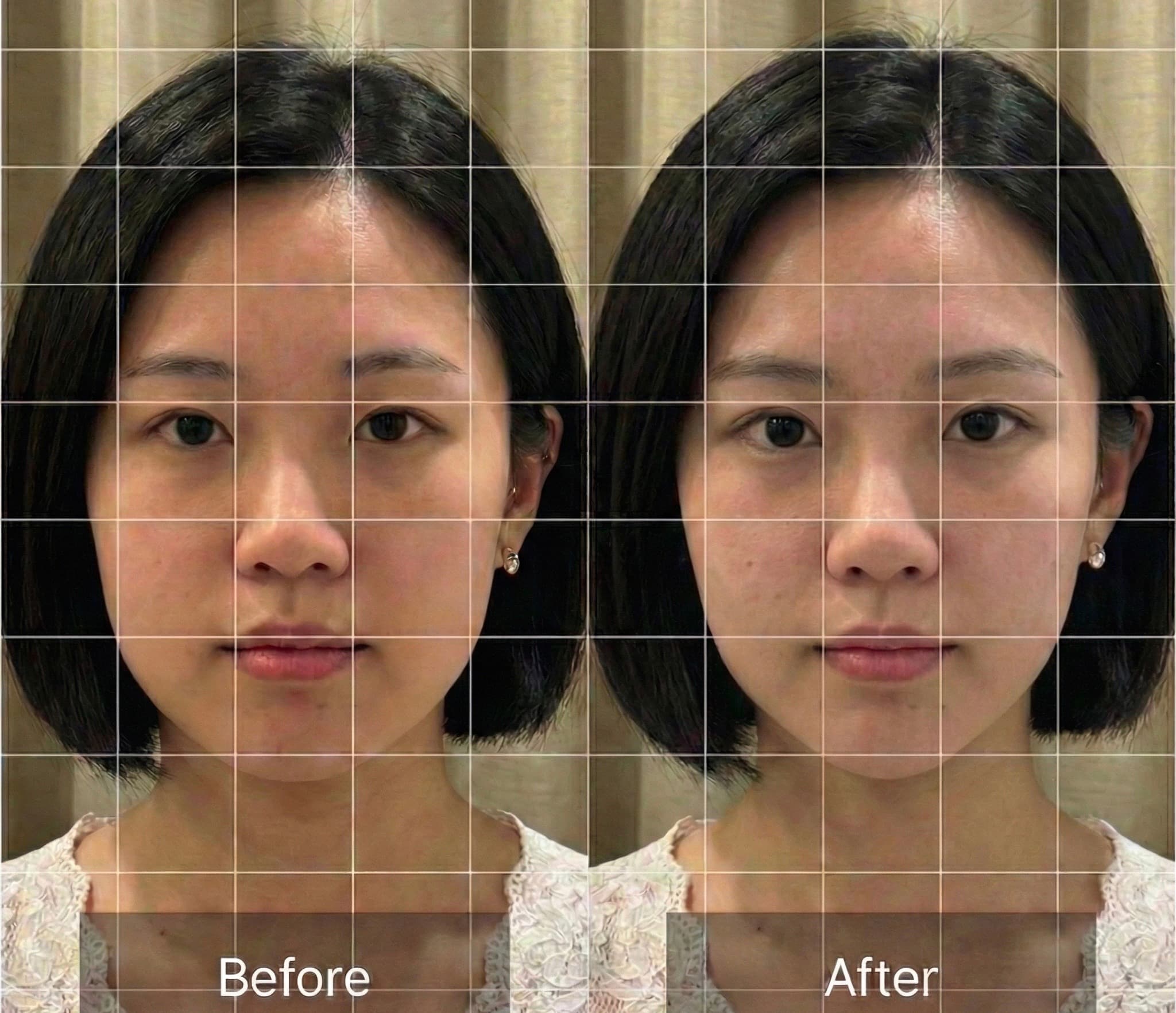 体重 −7.2kg / ウエスト −9cm ビフォーアフター